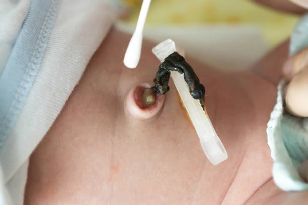 Quand Tombe le Cordon Ombilical de Bébé ? Guide Complet